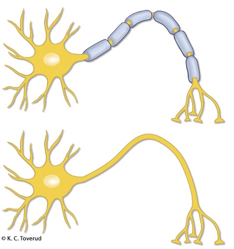 Nervecelle med og uten myelin